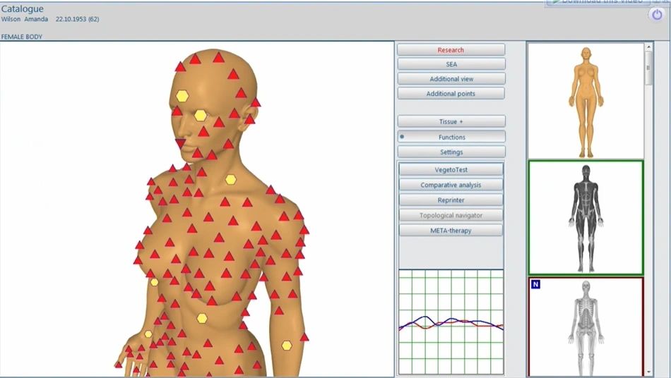 NLS Scanning System Interface